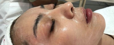 ​什么叫混干皮和混油皮