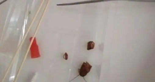 蟑螂怕风油精,蟑螂怕不怕风油精的味道图3