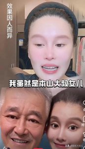 ​赵本山女儿球球自嘲自己鞋拔子脸，心态真好