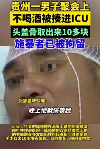 ​贵州男子聚会不喝酒被揍进ICU，头盖骨取出10多块 施暴者已拘留